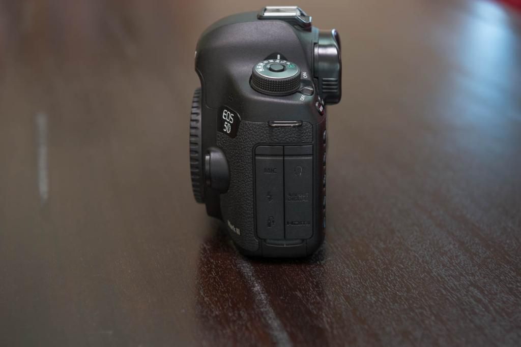 IMAGE: http://i281.photobucket.com/albums/kk202/youngortho/5D33of6.jpg