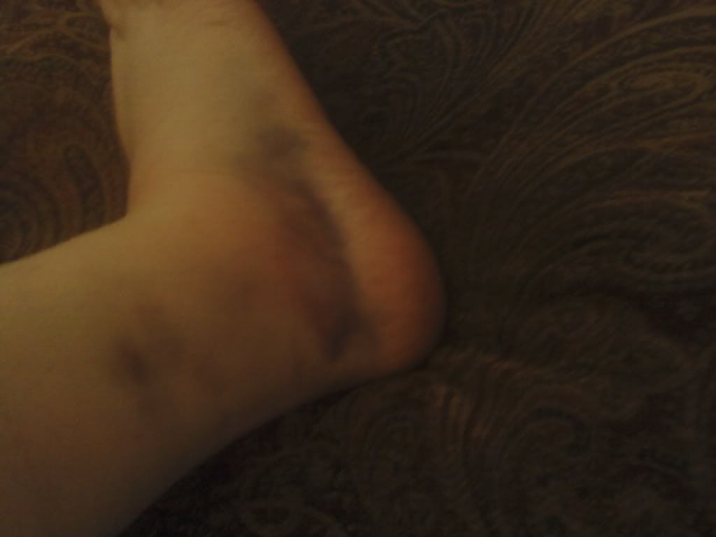  photo ankle.jpg